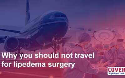 Why You Should Not Travel for Lipedema Surgery